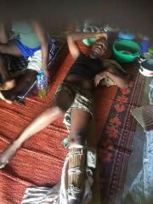 Police Beat Igbo Trader In Kano,Fractures His Bone Photos